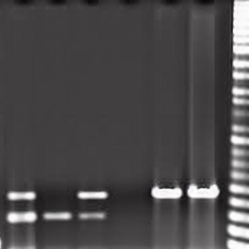 Electrophoresis-V1 image by moutoutan631