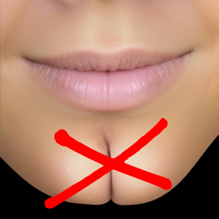 Chin Dimple Remover v1.0