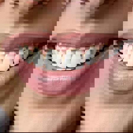 🦷 REAL FEMALE SMILE | Ultra-Detailed Teeth & Lips Macro LoRA v1.0