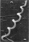Bacterial_Inflammation