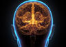 Twinmind00