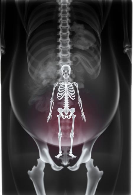 xray of a pregnant woman with tiny skeleton inside her belly