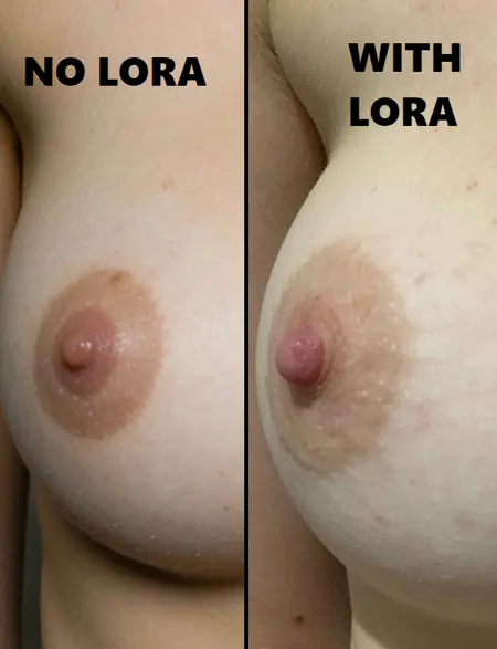 WAN Nipple FIX