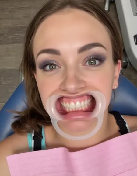 Dental Cheek Retractor FLUX