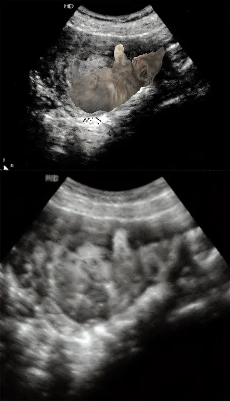 b超模型-哈基米